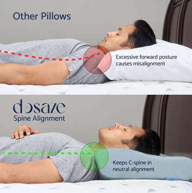 Back sleeper spine alignment: other pillows vs Dosaze Pro